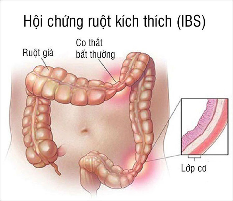 trieu-chung-an-do-tanh-bi-dau-bung-di-ngoai